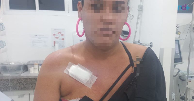 Trans é vítima de golpes de faca durante assalto em São João Batista