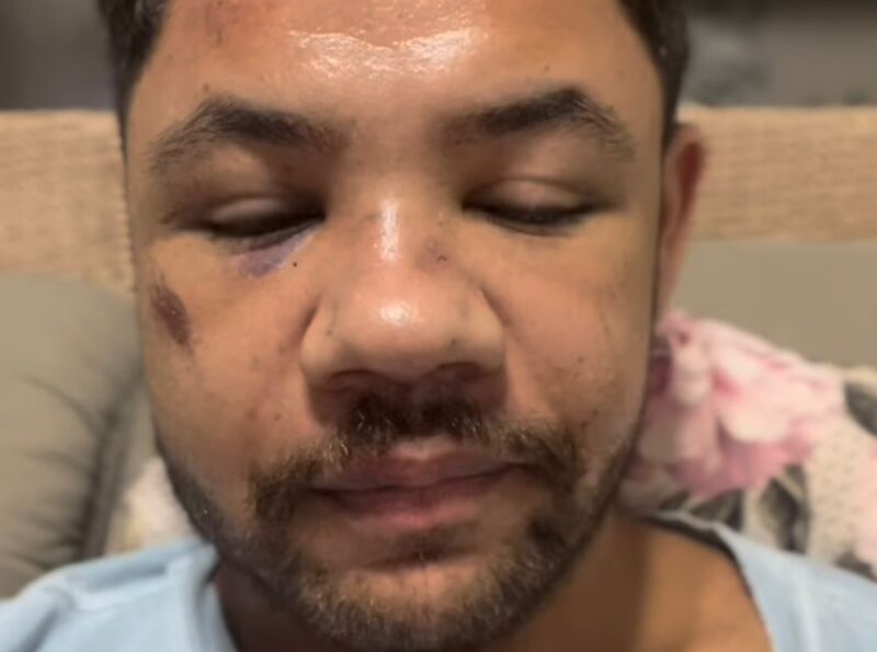 “Viadinho de merda”: homem denuncia tortura e espancamento em praia de Balneário Camboriú
