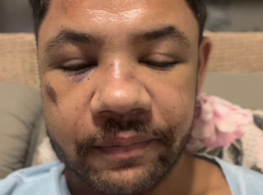 “Viadinho de merda”: homem denuncia tortura e espancamento em praia de Balneário Camboriú