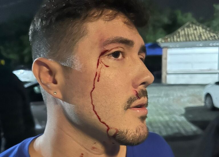 Empresário LGBT denuncia agressão em Balneário Camboriú