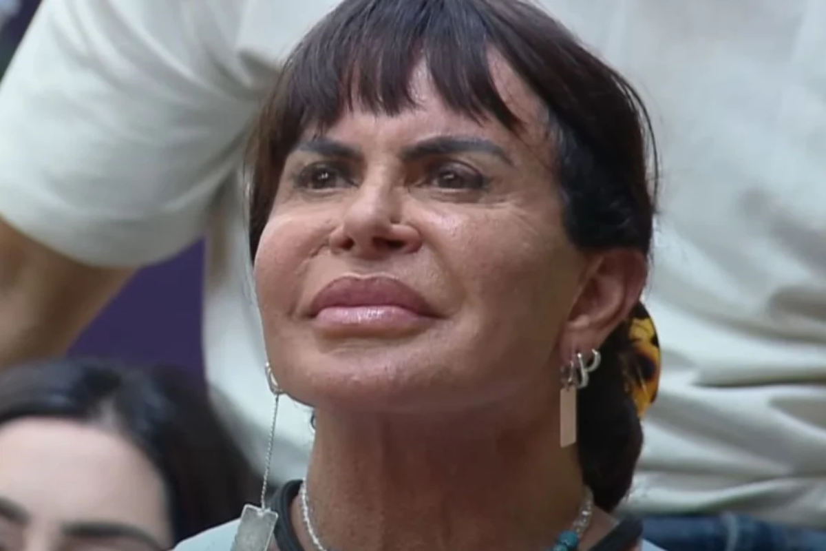 Gretchen aparece com nova harmonização facial: ‘rosto ficou fininho!’